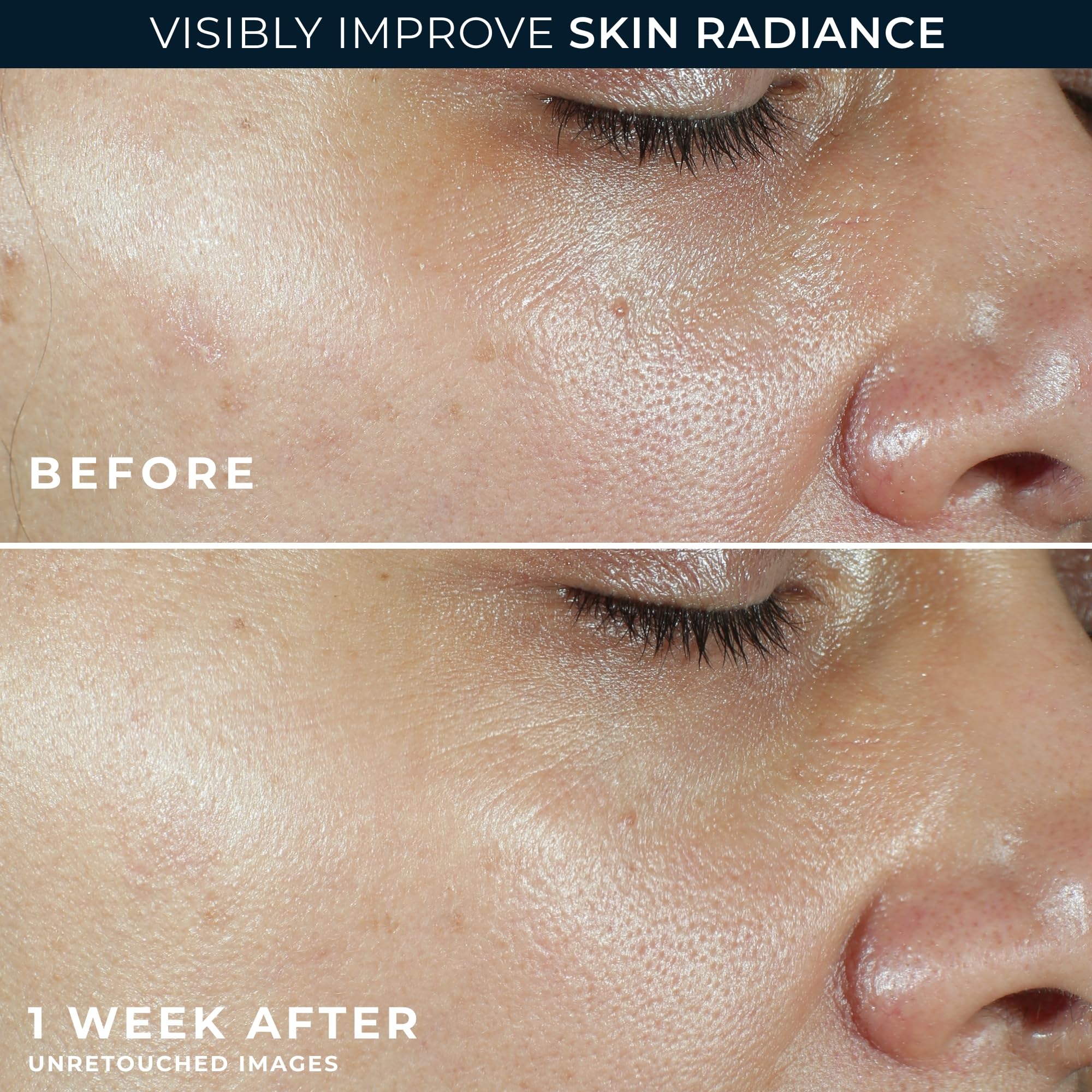 RoC retinol eye cream packette targets delicate eye area.
