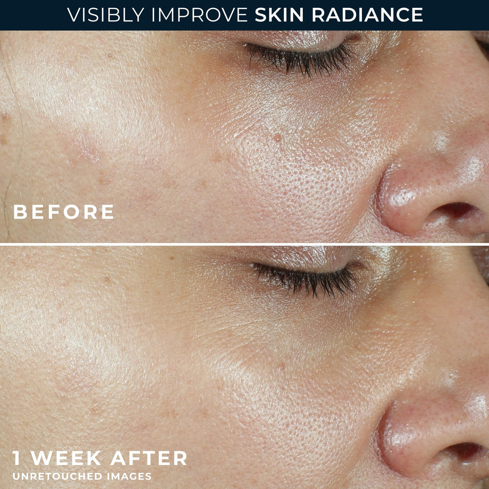 RoC retinol eye cream packette targets delicate eye area.