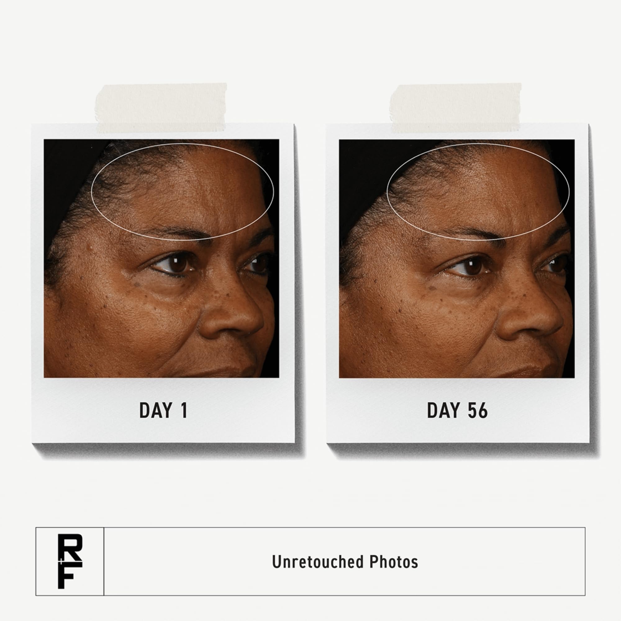 RODAN FIELDS Redefine Daily Face Clay Cleanser mask in use for pore refining during cleansing.