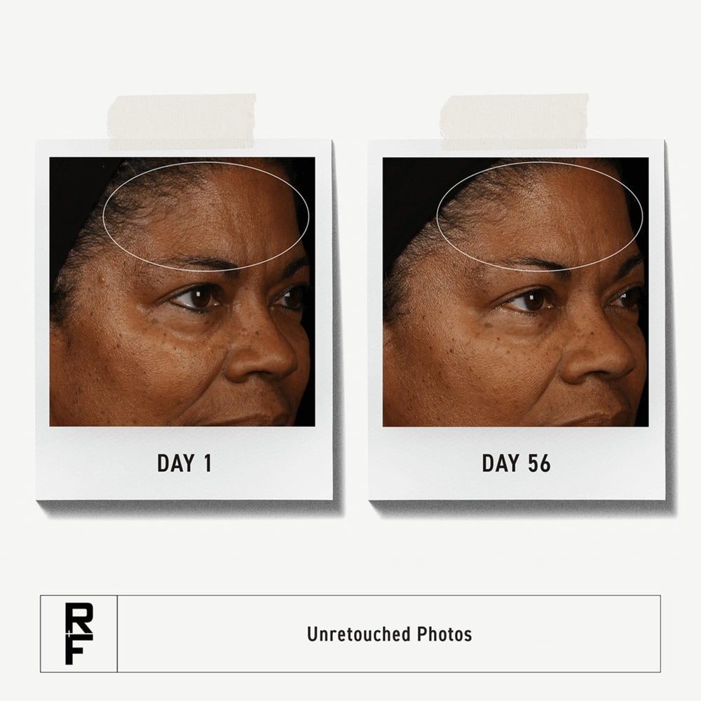 RODAN FIELDS Redefine Daily Face Clay Cleanser mask in use for pore refining during cleansing.