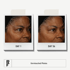 RODAN FIELDS Redefine Daily Face Clay Cleanser mask in use for pore refining during cleansing.