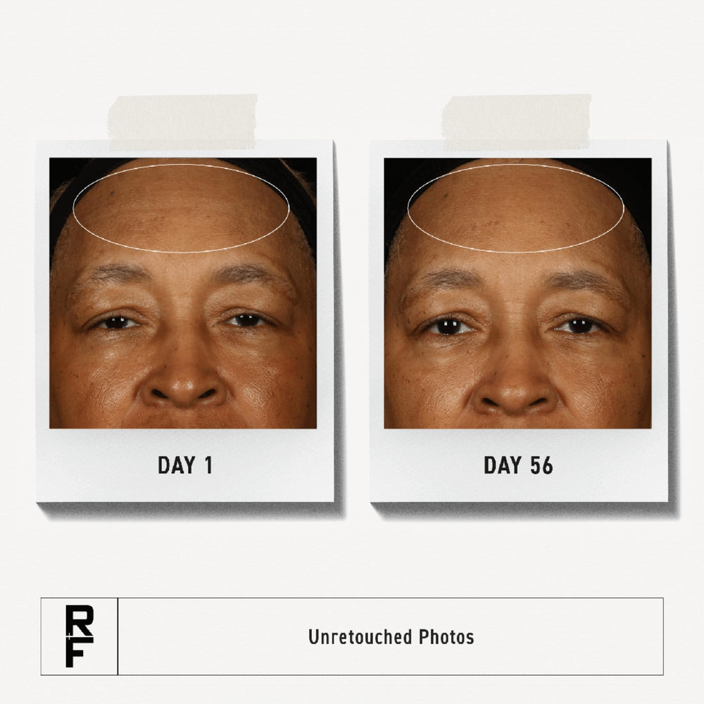 Rodan + Fields ReDefine Triple Defense Cream face close-up with smooth skin glow