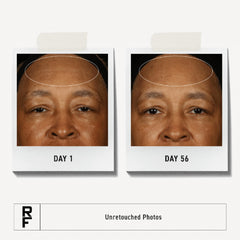 Rodan + Fields ReDefine Triple Defense Cream face close-up with smooth skin glow