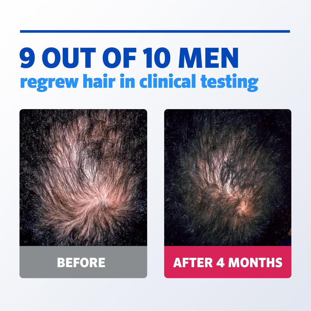 Rogaine bottle label highlights 1-month supply for men