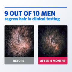 Rogaine bottle label highlights 1-month supply for men