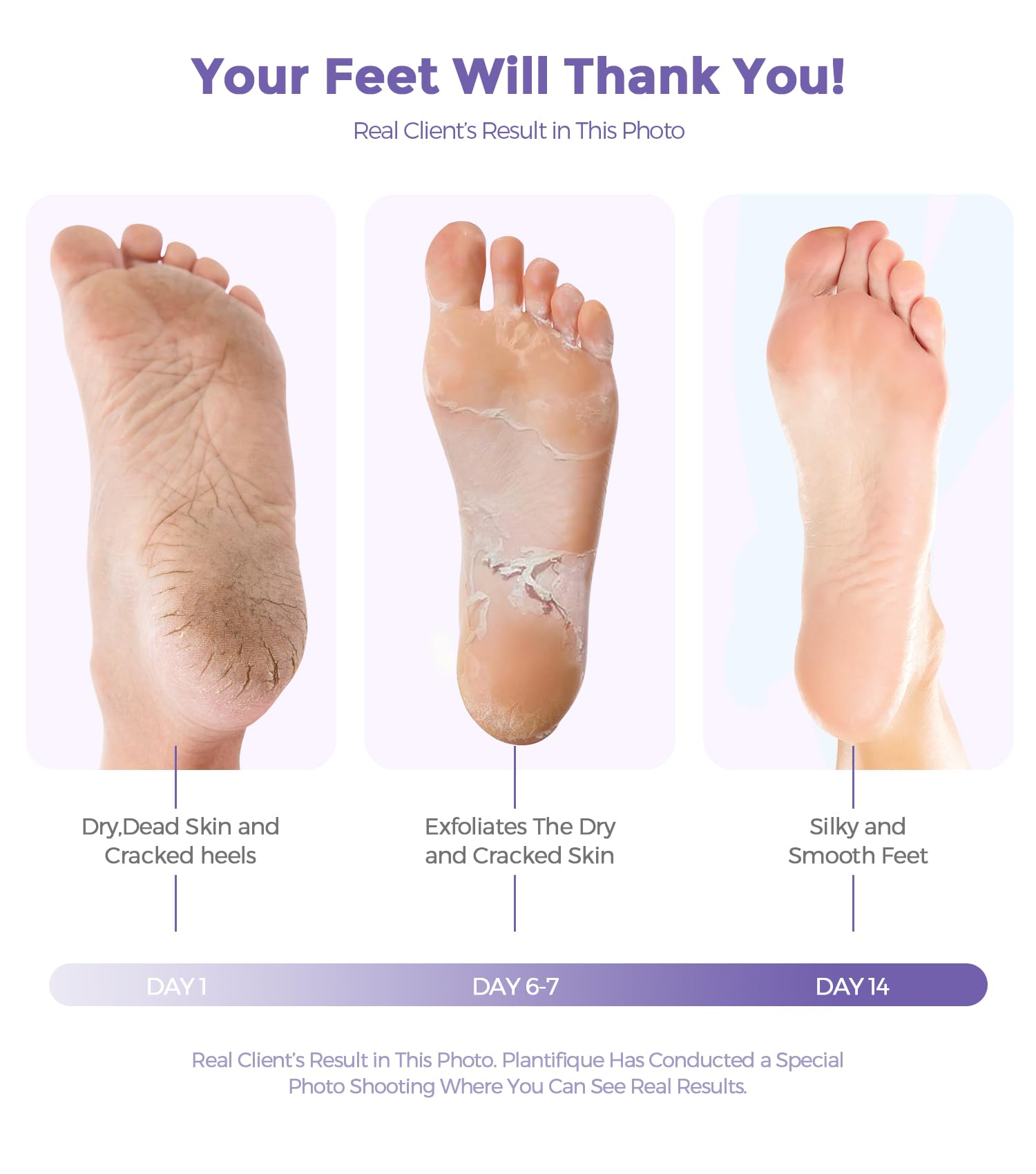 Pies secos y suaves tras la exfoliación con Rokelos lavanda.