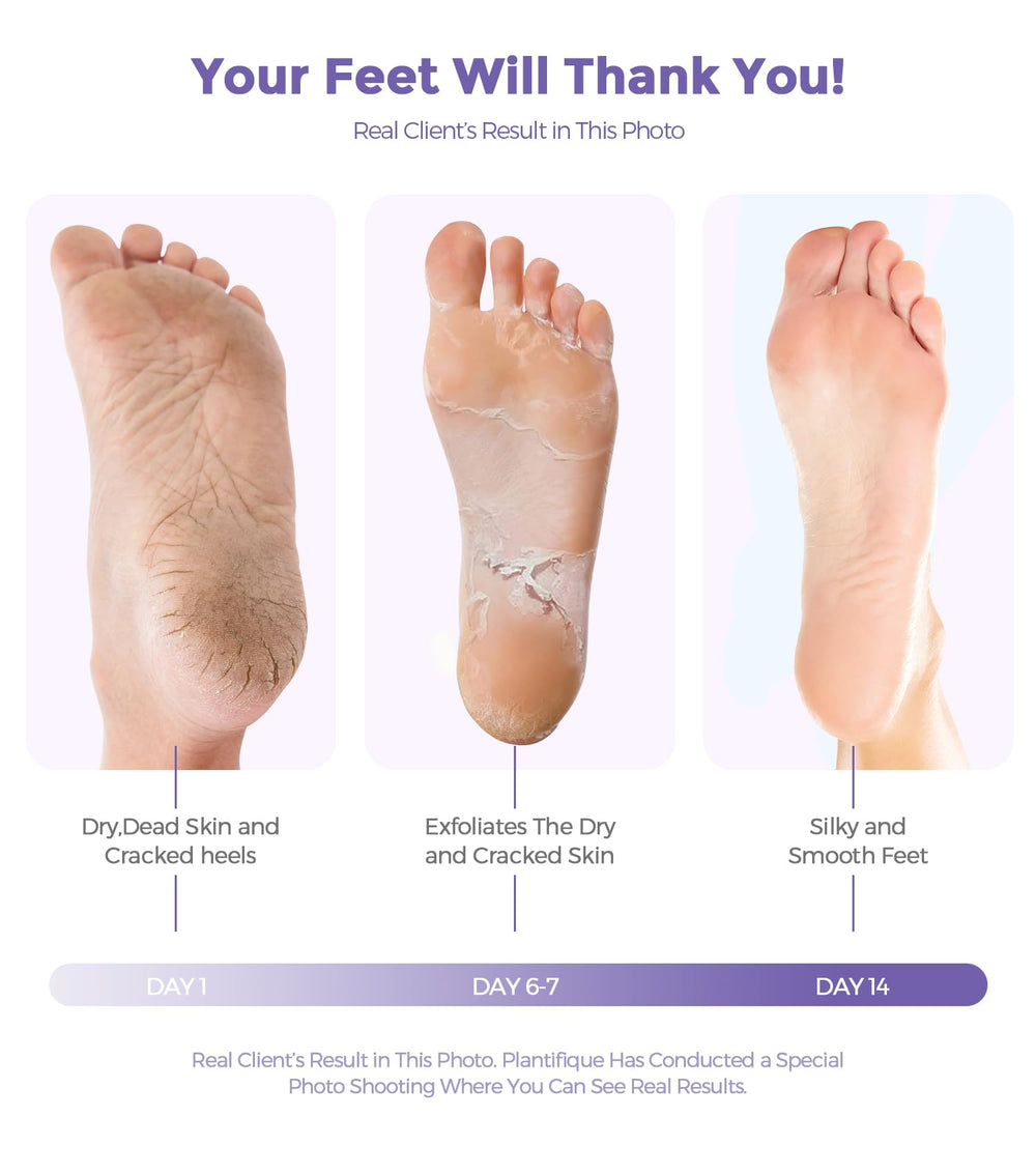 Pies secos y suaves tras la exfoliación con Rokelos lavanda.