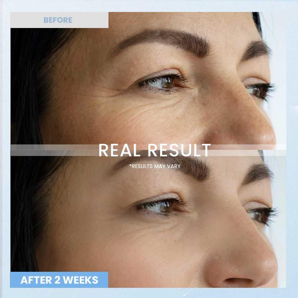 RONKIE crema de ojos retinol, dosis nocturna para cuidado constante.