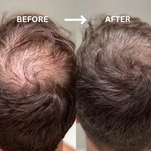 ROOT’D Hairline Powder breathable-finish provides weightless, natural density between washes.
