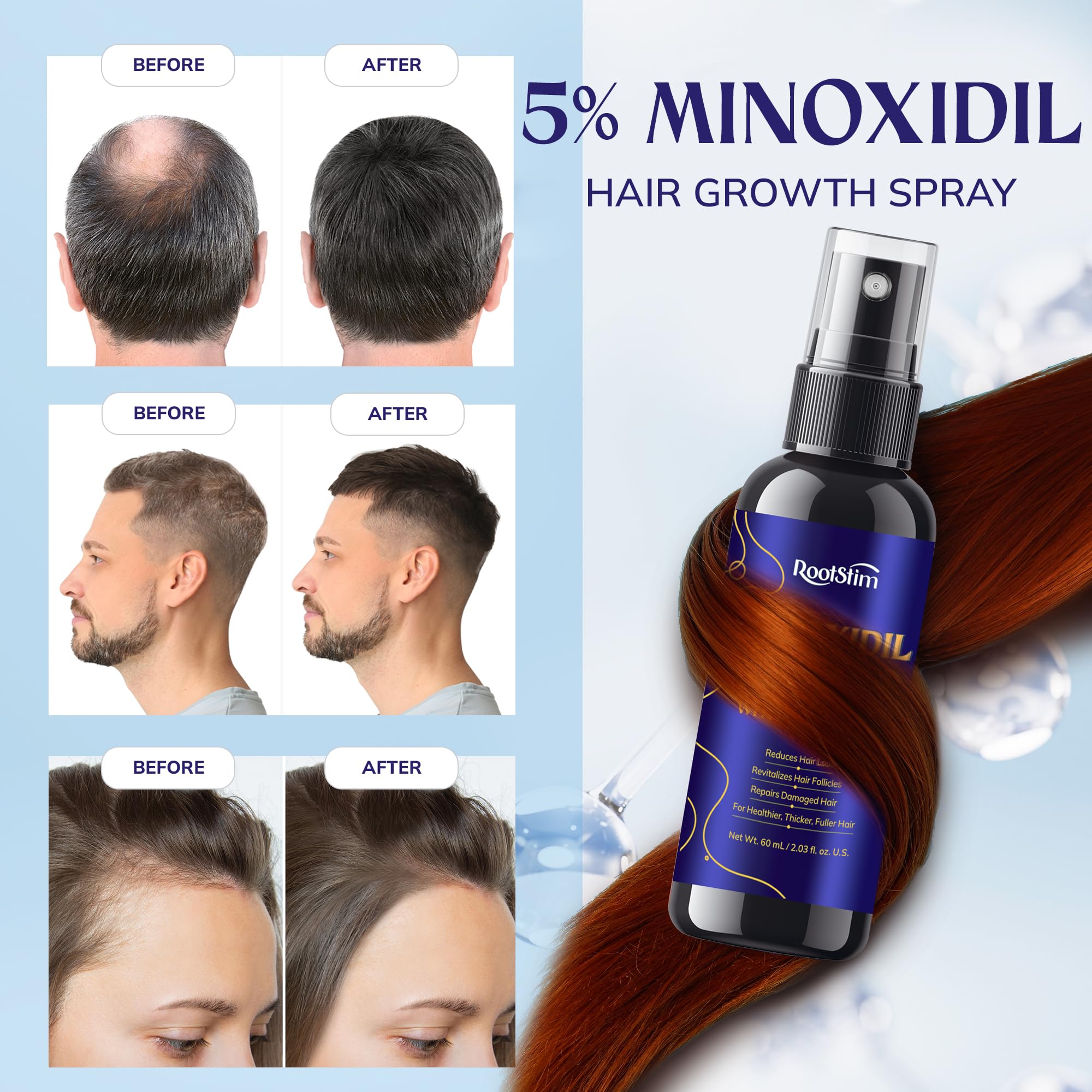 Applying RootStim to a dry scalp thinning area