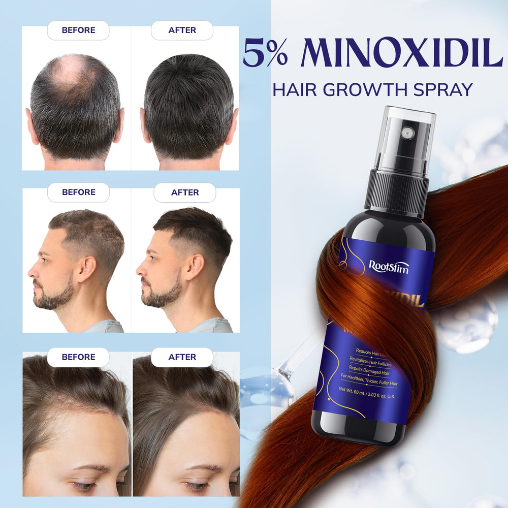 Applying RootStim to a dry scalp thinning area