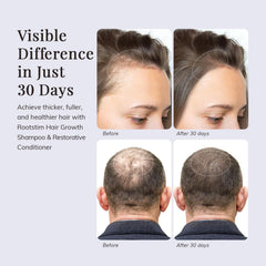 RootStim ginger root and tea tree oil on scalp for comfort.