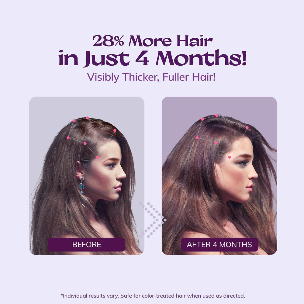 RootStim rosemary biotin formula nourishes the scalp for stronger roots.