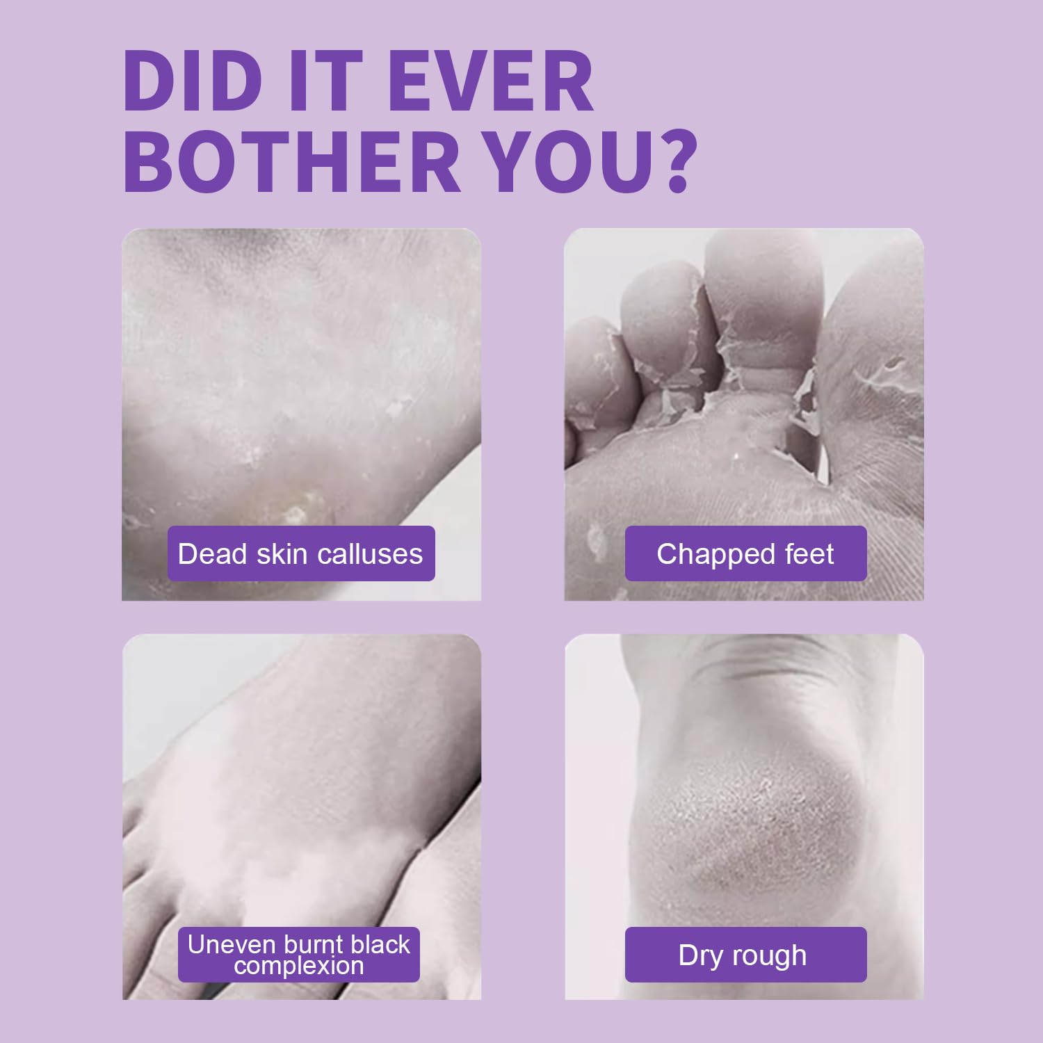 ROUSE Foot Peeling Mask at-home spa setup for relaxation