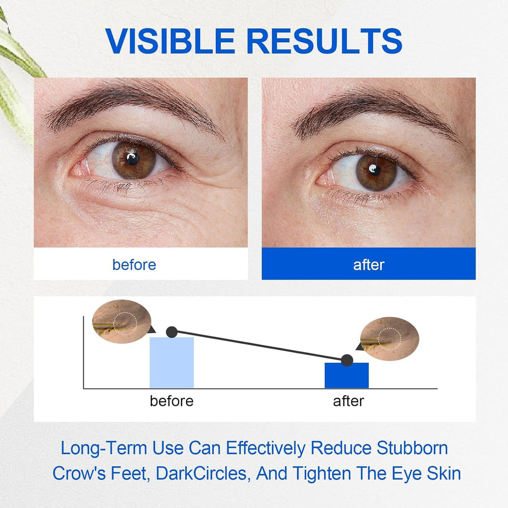 ROUXUN crema de ojos retinol con cafeína y colágeno para nutrición.