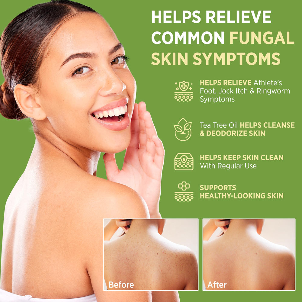 RoyceDerm Antifungal Bar Soap – face and body cleansing with 1% clotrimazole.