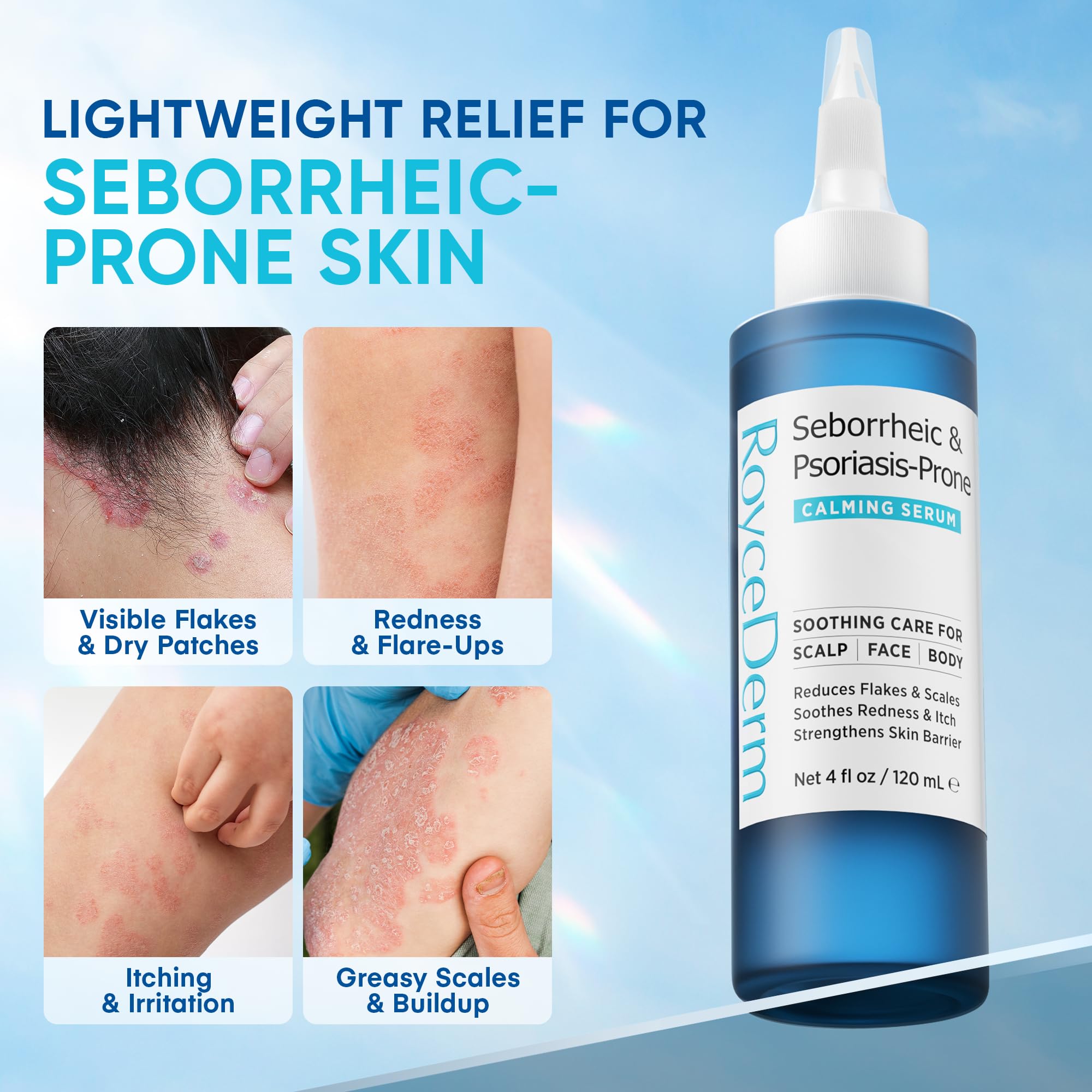 Roycederm serum application demonstrates easy daily scalp use and absorption.