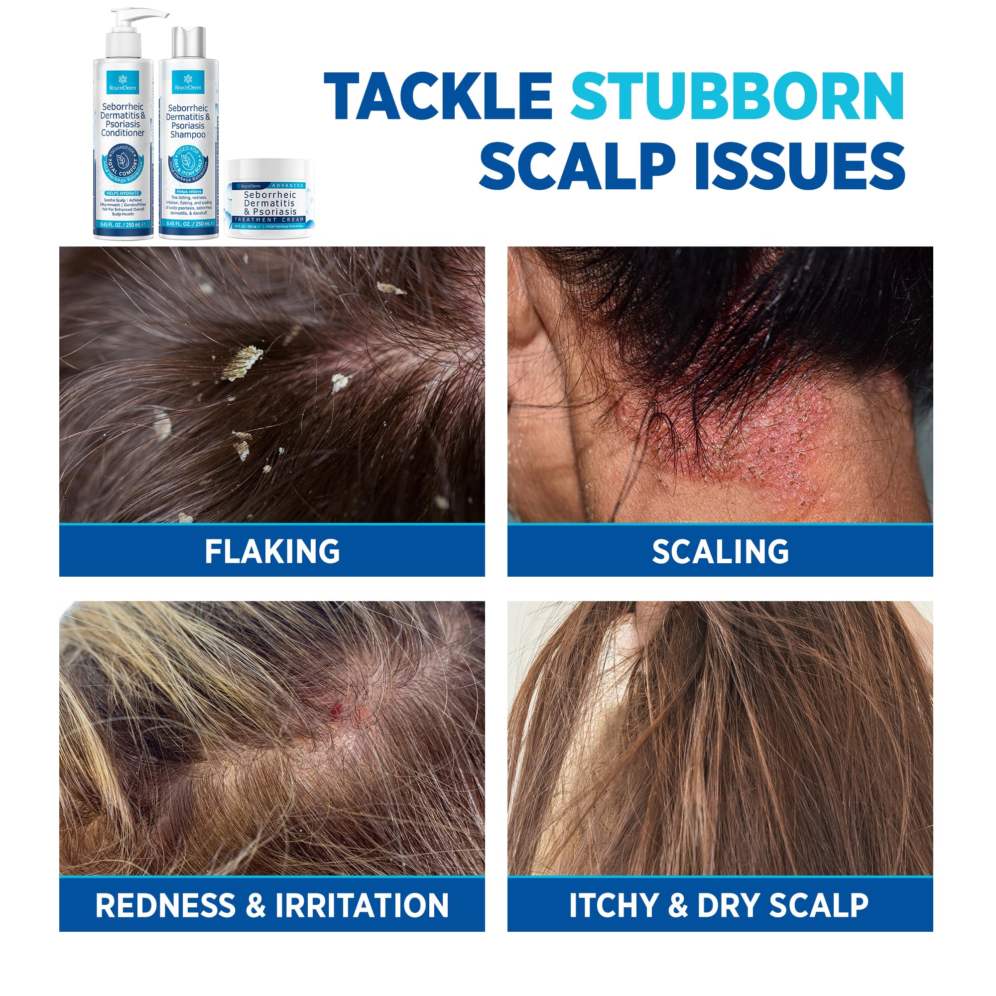 Roycederm Set packaging highlights complete scalp care in one kit.