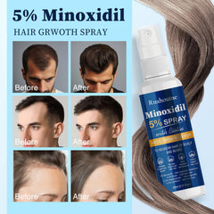 Ruahouine Minoxidil 5% cabello antes del tratamiento con mejor aspecto
