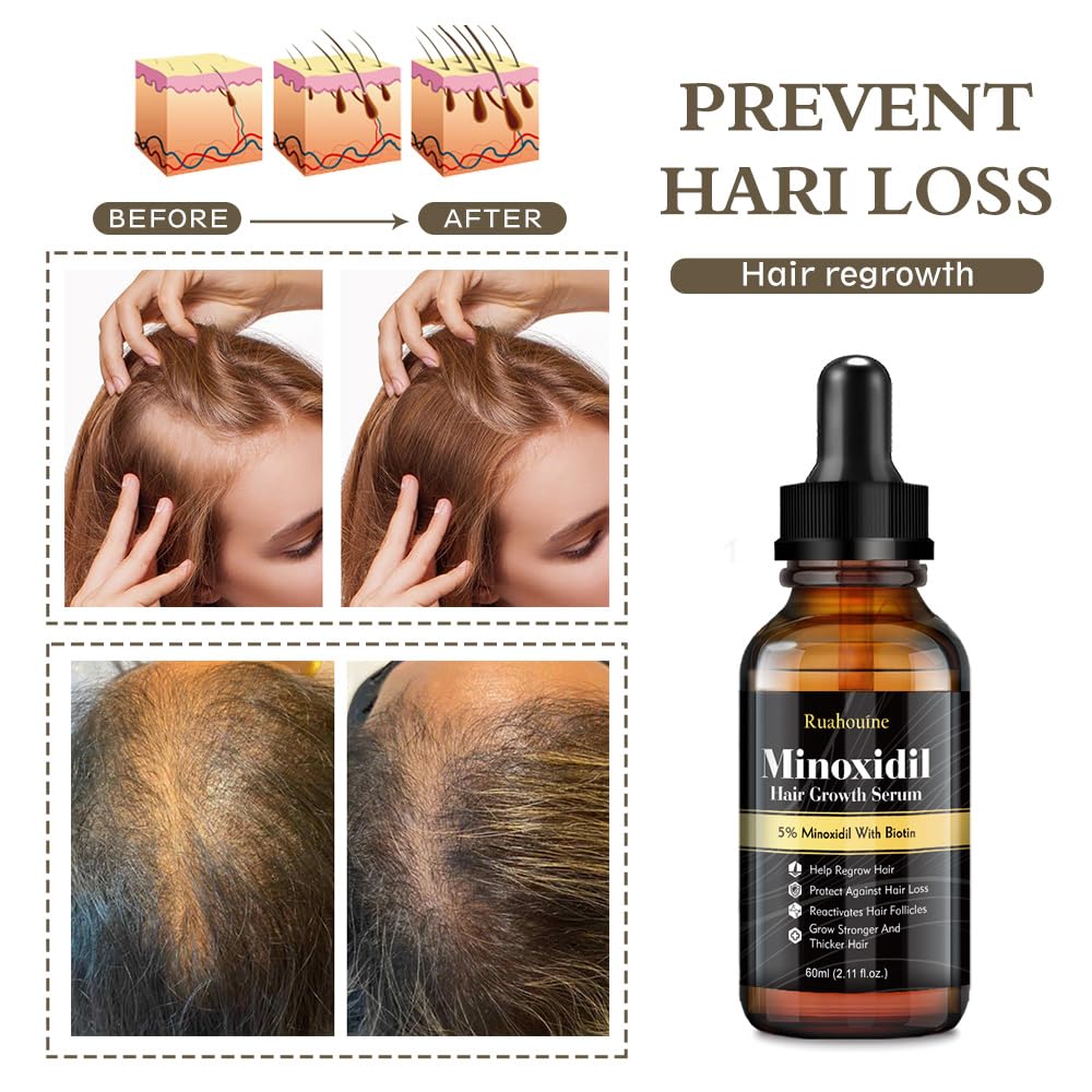 Ruahouine Cabello protección ramas serum: cuida raíces y puntas para un aspecto saludable.