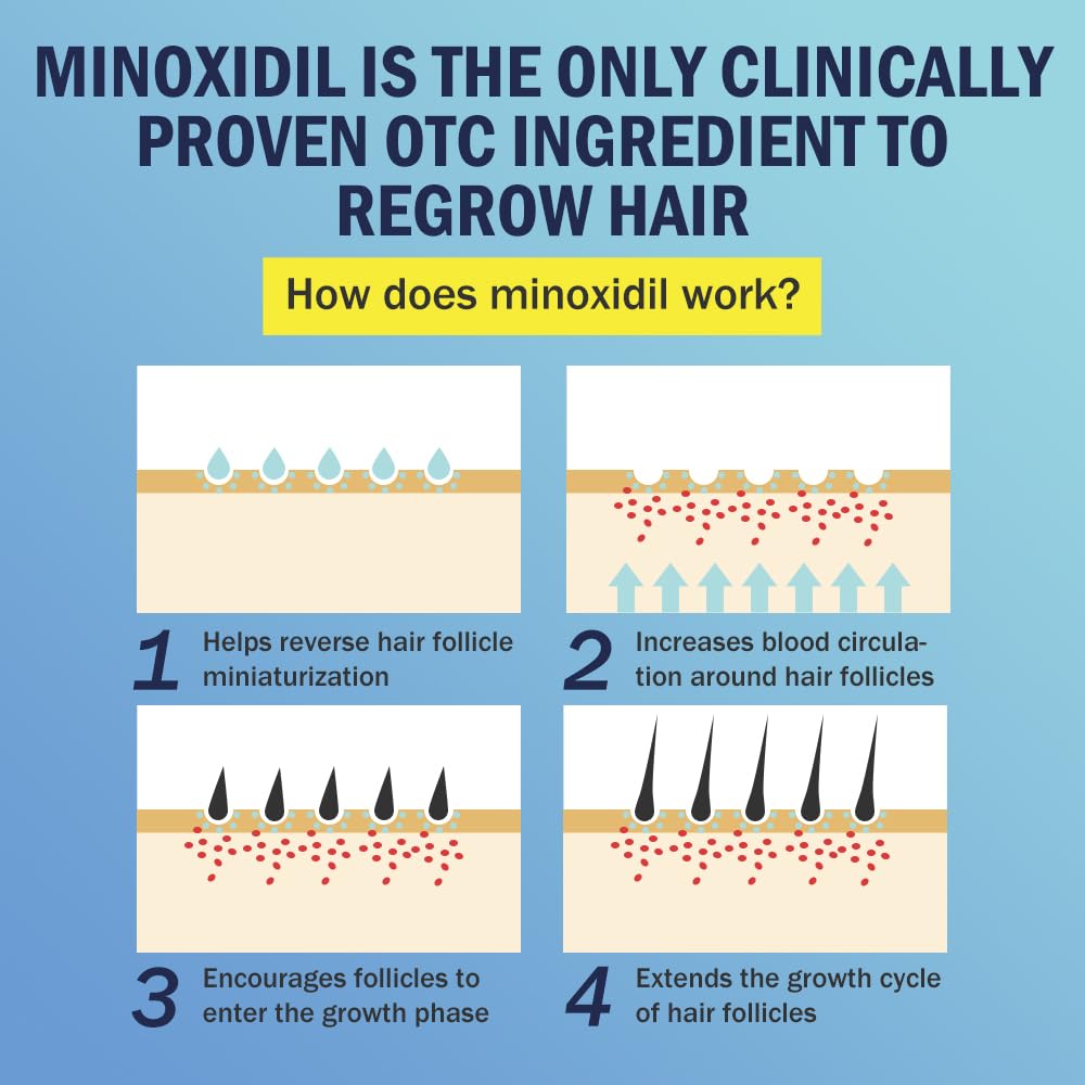 Ruahouine Minoxidil espuma regeneración capilar: puede contribuir a un aspecto más denso.