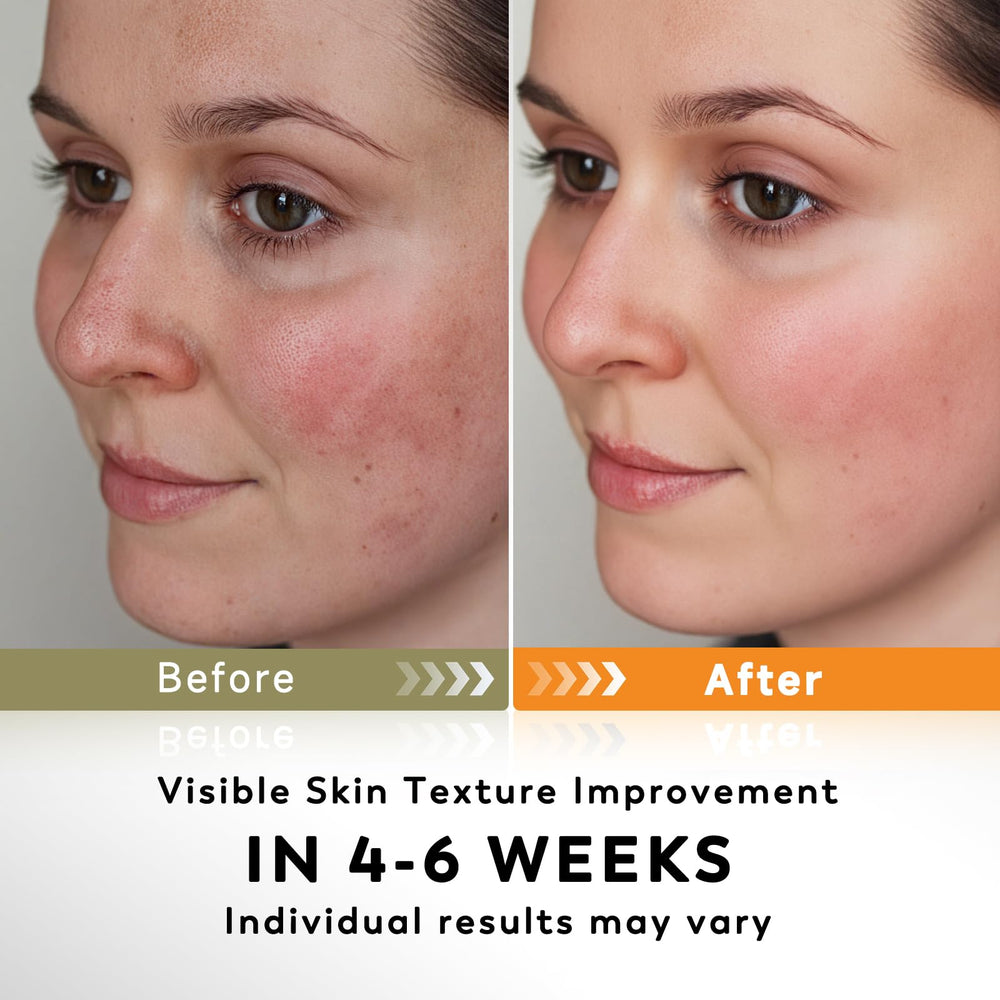 Almohadillas Rvlaim curcuma-acido-kojico exfolian suavemente la piel