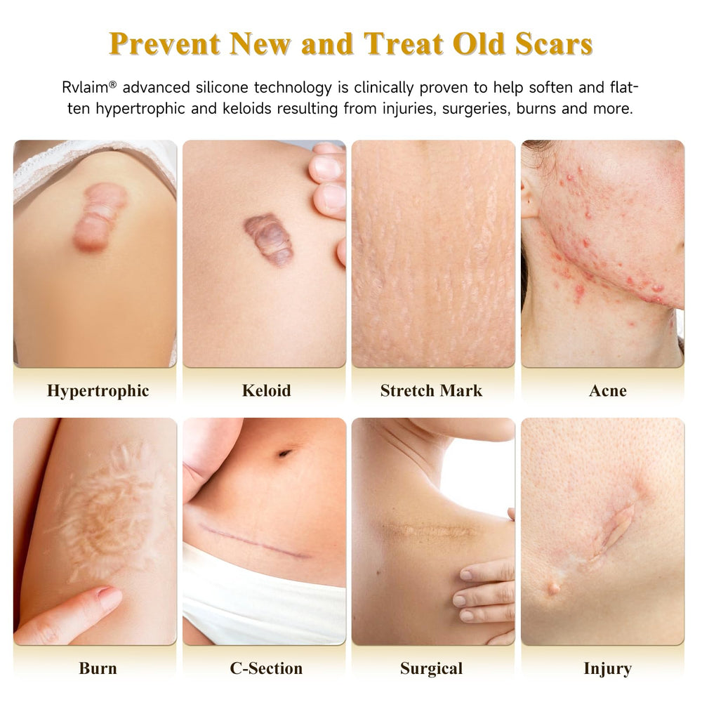 Rvlaim Scar Cream silicone gel absorbs quickly for smooth, non-greasy skin.