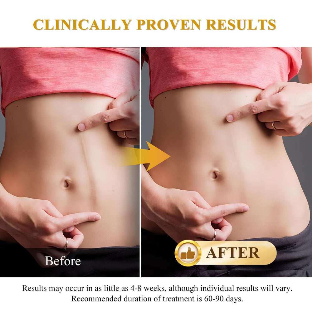 Rvlaim Scar Cream skin-tone blend helps scars disappear into natural complexion.