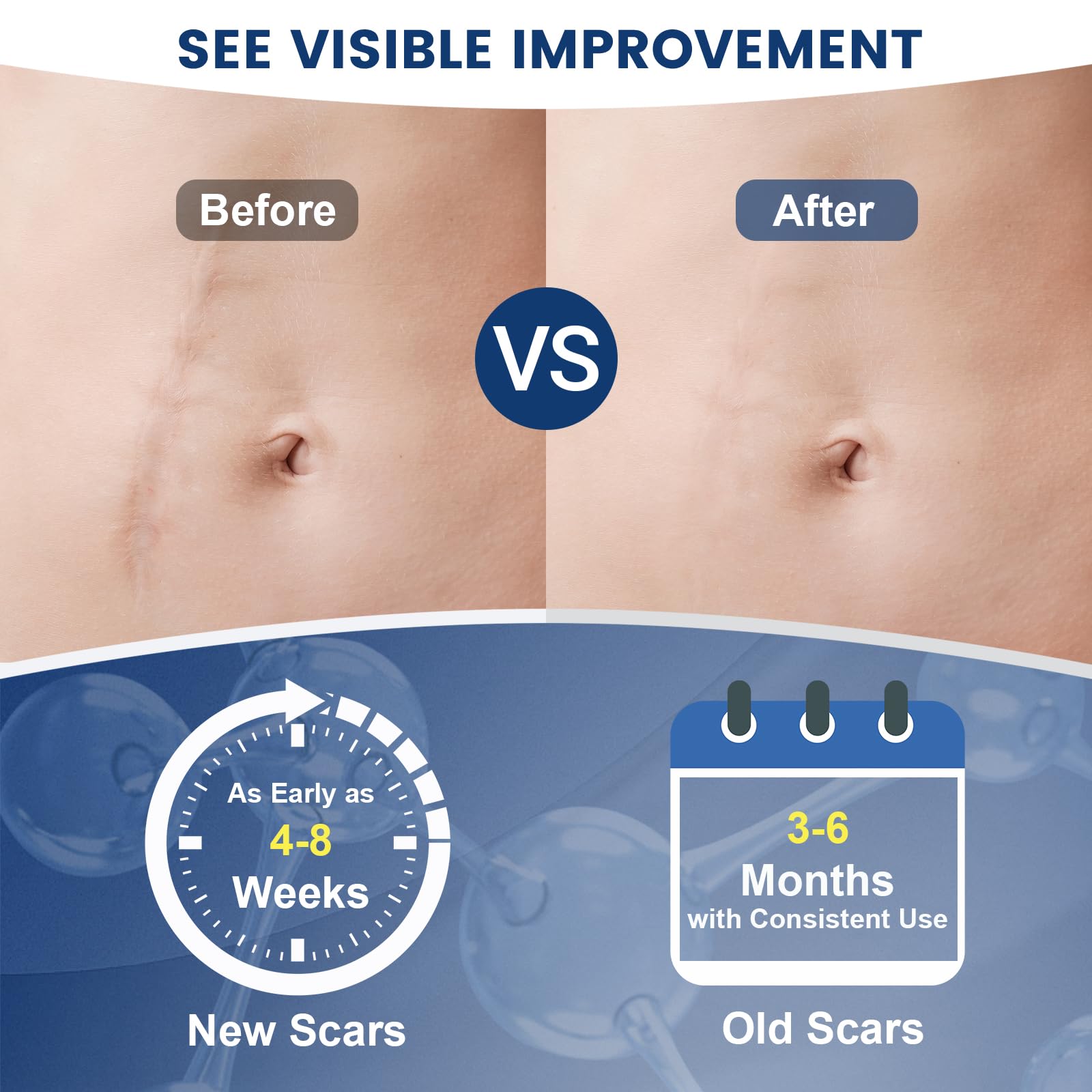 Rvlaim Scar Gel application area illustrating even coverage on skin.