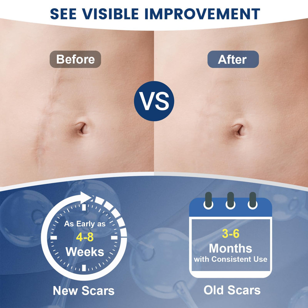Rvlaim Scar Gel application area illustrating even coverage on skin.