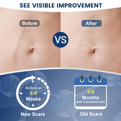 Rvlaim Scar Gel application area illustrating even coverage on skin.