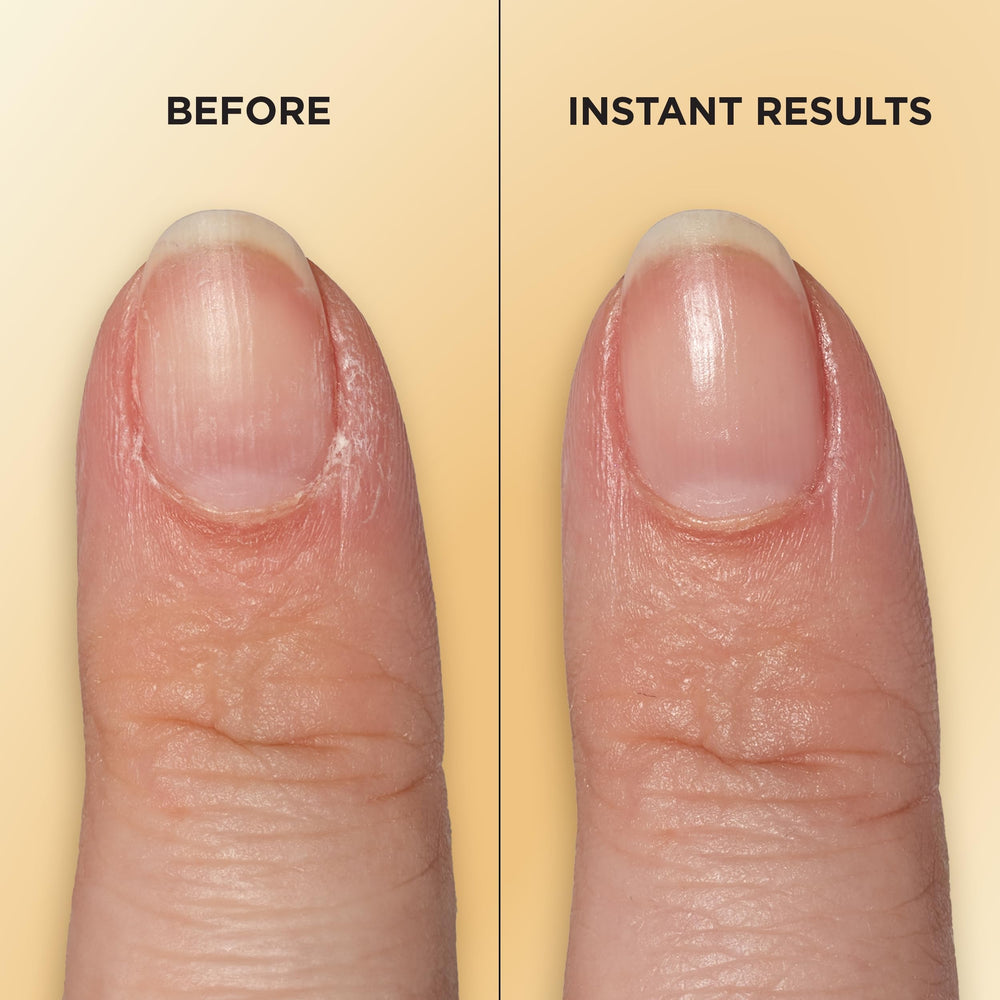 Bolígrafo Sally Hansen mejora la flexibilidad de las uñas.