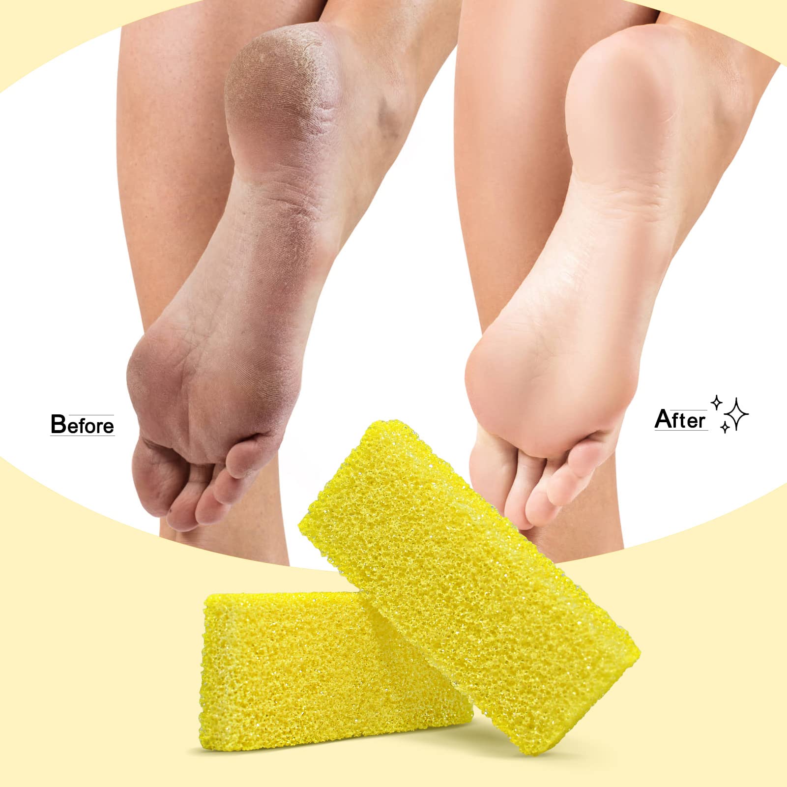 Blue coarse SALVMARY pads for heavy callus removal and exfoliation