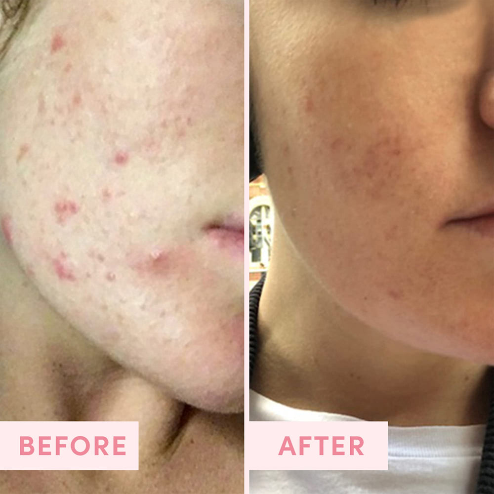 Australian Pink Clay origin from Sand and Sky for detox care.