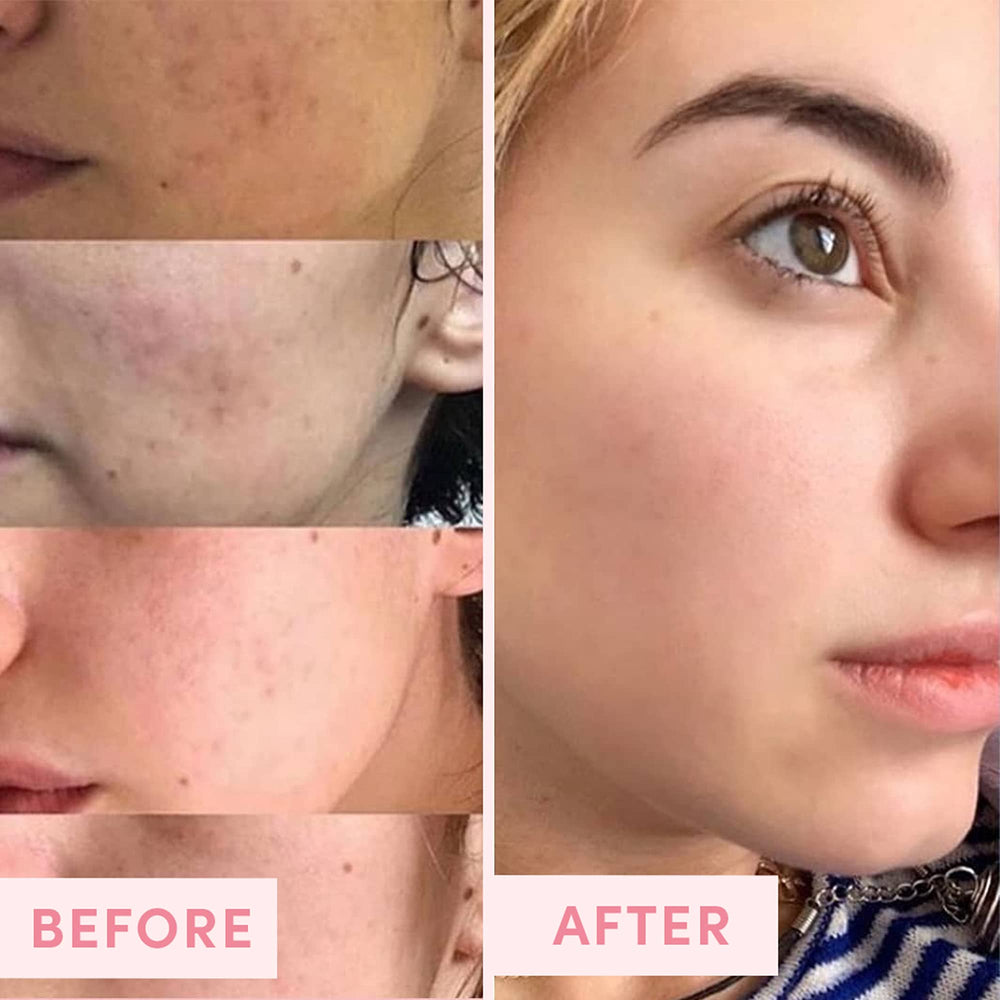 Sand and Sky pore refinement effect visible on skin.