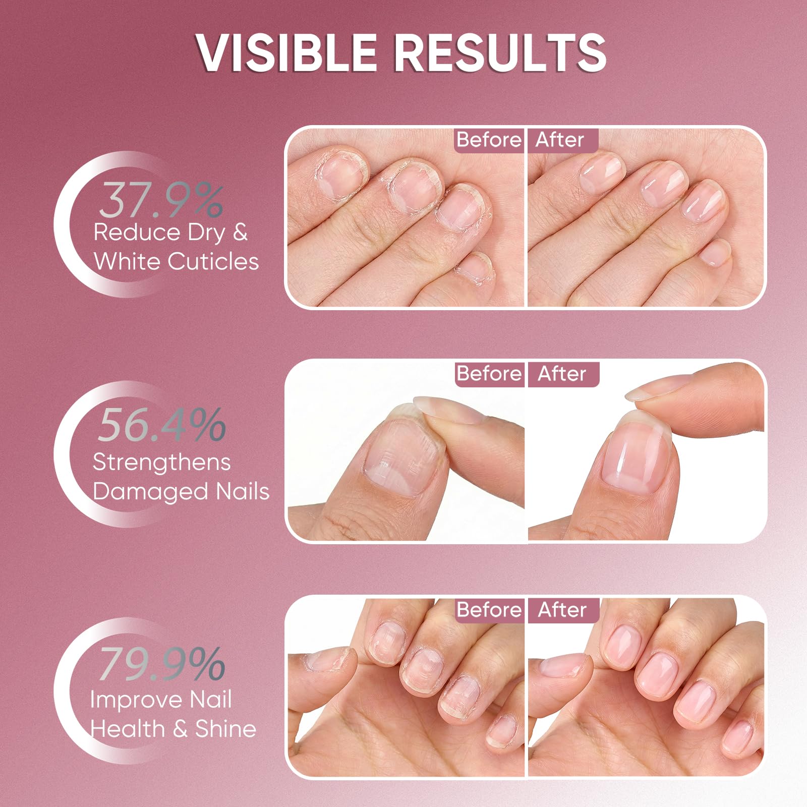 SASSYTIP Hydration for dry cuticles without greasiness