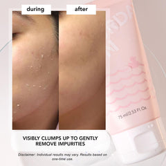 Saturday Skin Rub-A-Dub Refining Peel Gel con enzimas de papaya y piña para exfoliar.