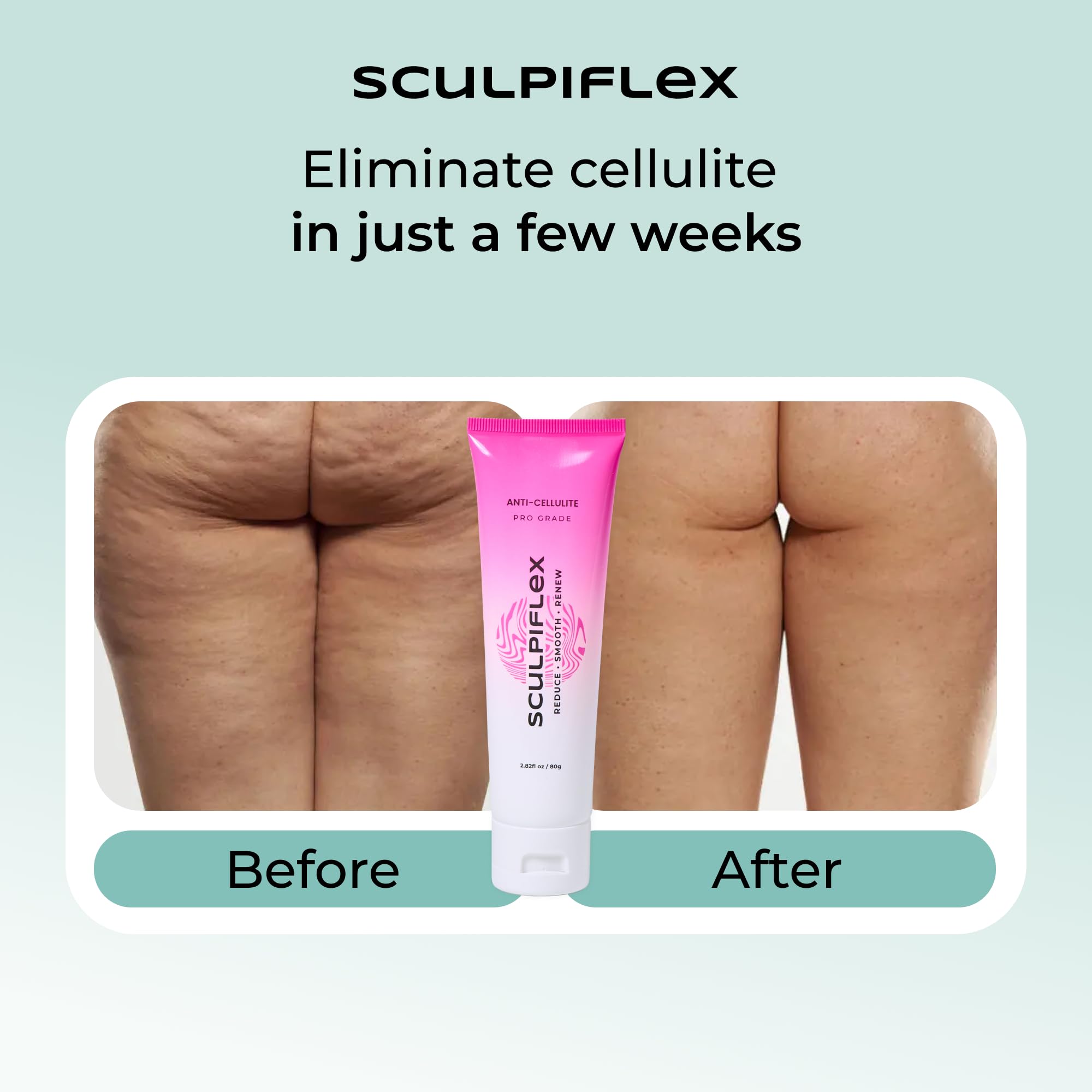 SCULPIFLEX cream on hip area illustrating targeted toning potential.