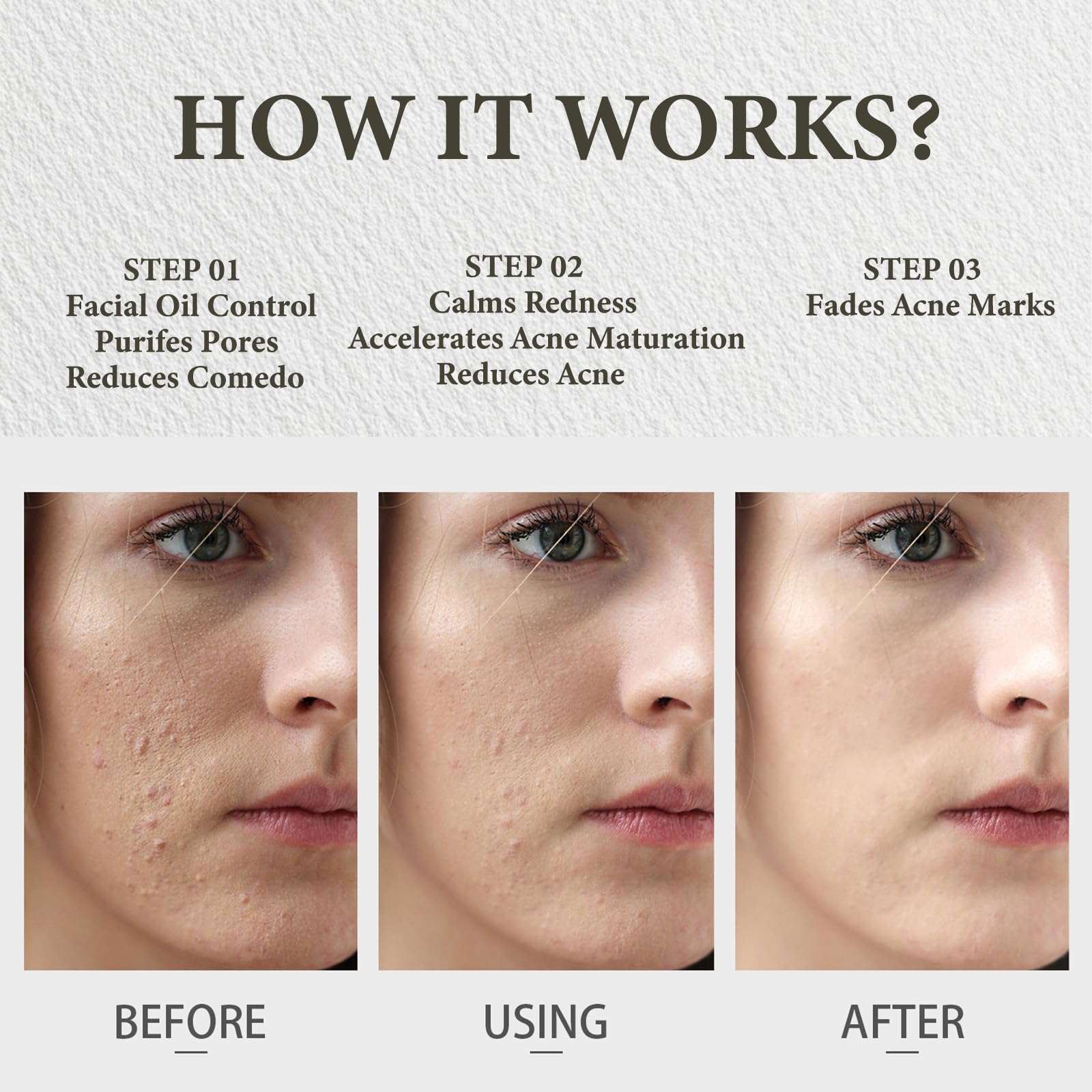 Beeswax and vitamin E support barrier and oil regulation in the SDXJIOGE balm.
