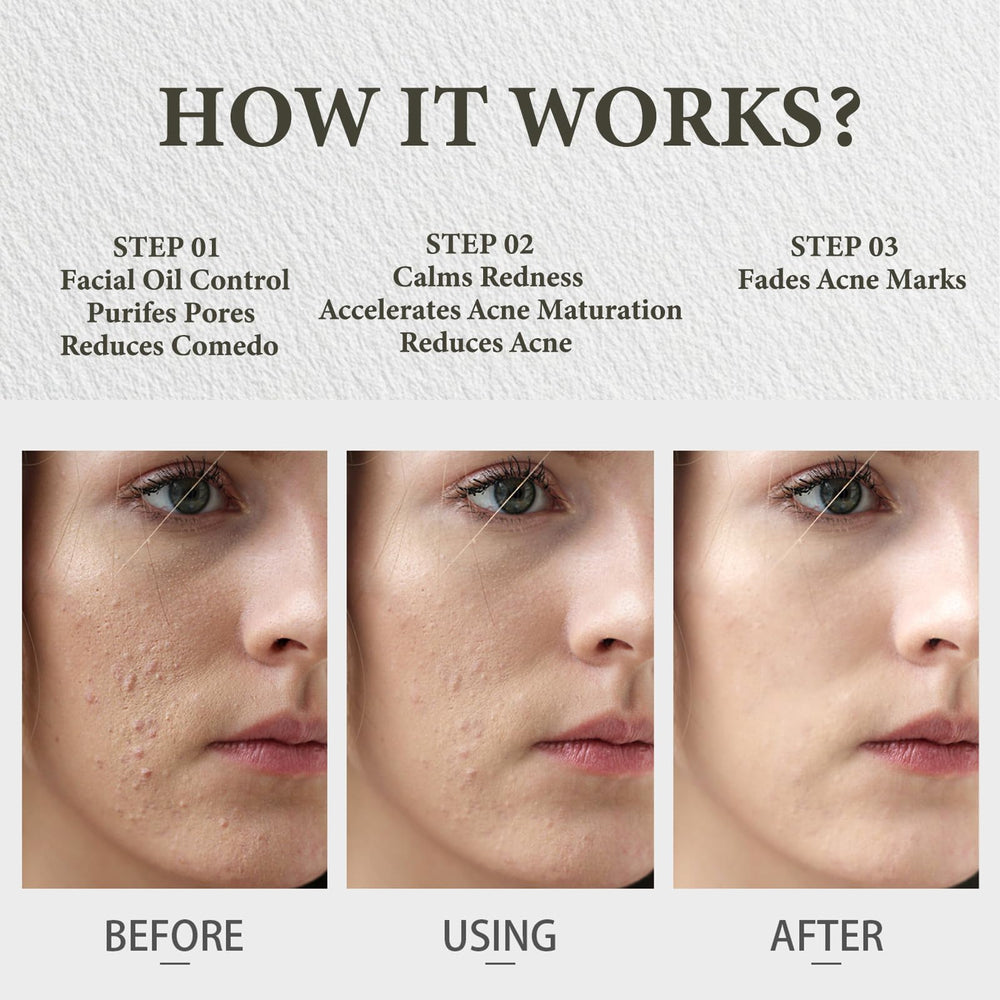 Beeswax and vitamin E support barrier and oil regulation in the SDXJIOGE balm.