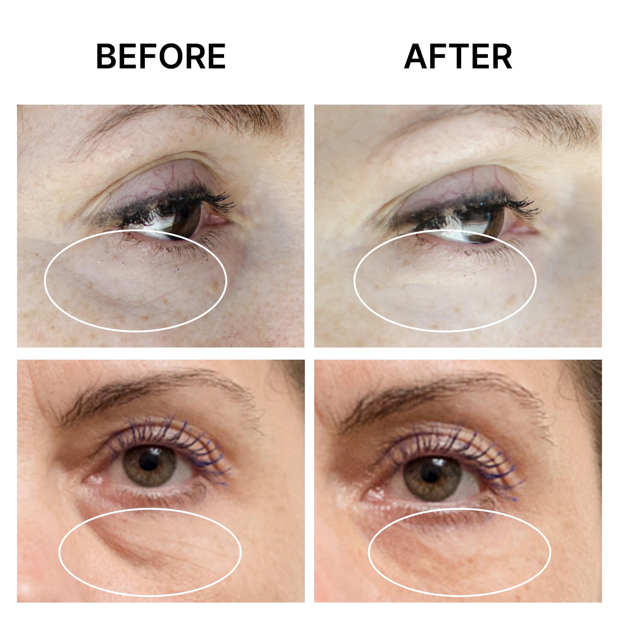 SEAMANTIKA Eyeliss complex illustration explaining fast under-eye tightening effects