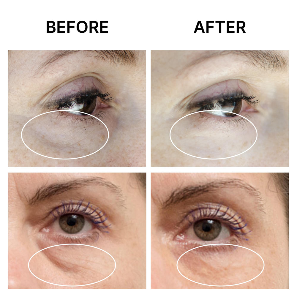 SEAMANTIKA Eyeliss complex illustration explaining fast under-eye tightening effects
