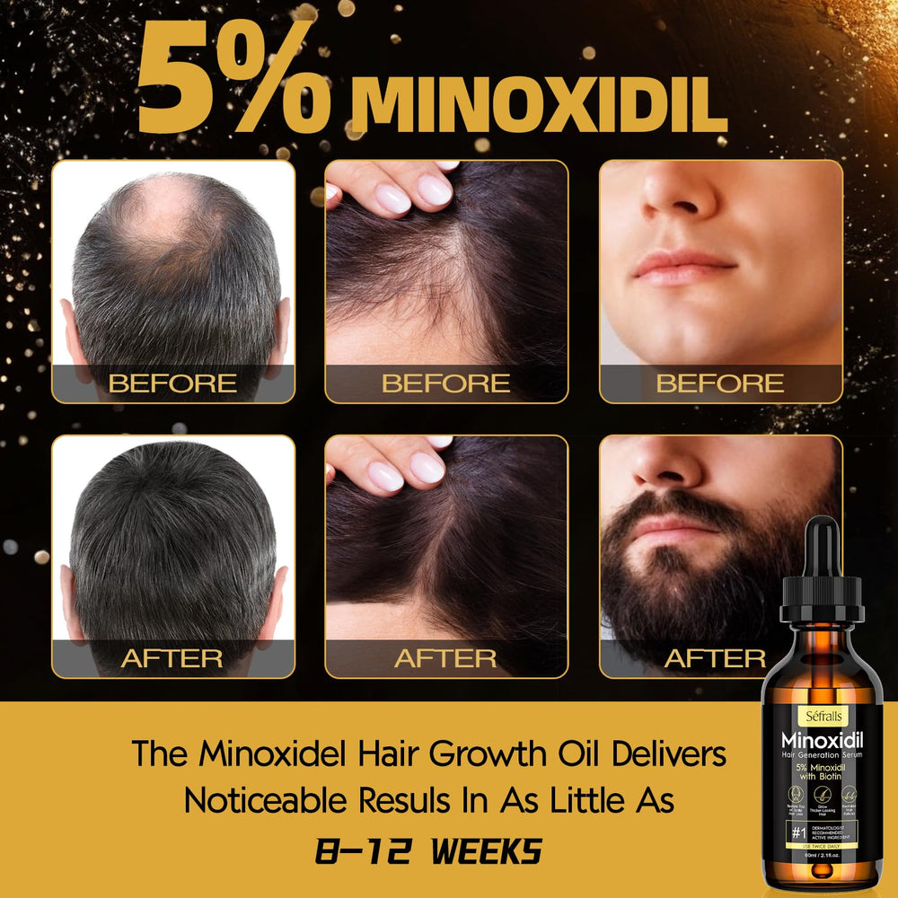 Sefralls Biotina Suero Cabello Nutrición: fortalece raíces y favorece mechones sanos.