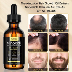 Sefralls Minoxidil, cabello más denso y saludable.