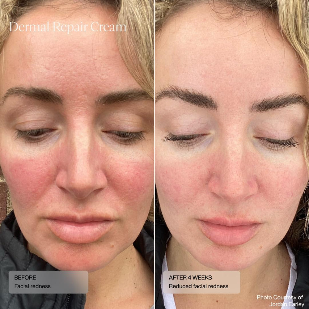 Close-up of Sente Dermal Repair Facial Cream pump for precise application.
