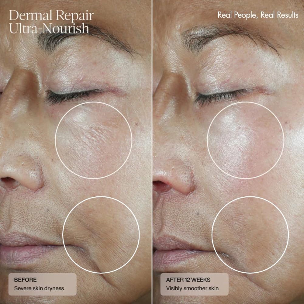 Clinical results panel for Senté Dermal Repair Ultra-Nourish showing hydration improvement.