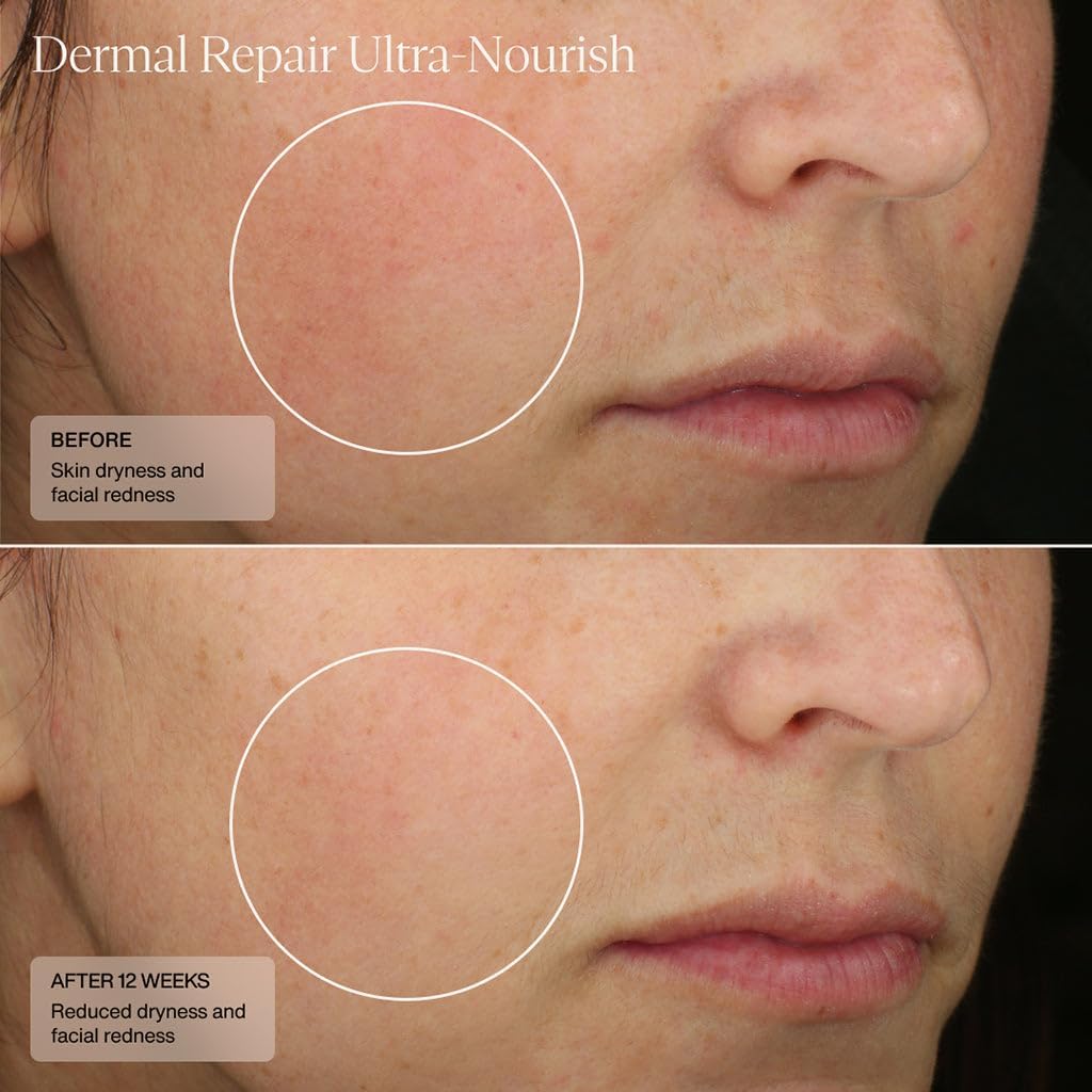 Retinol-friendly use with Senté Dermal Repair Ultra-Nourish illustrated for layering routine.
