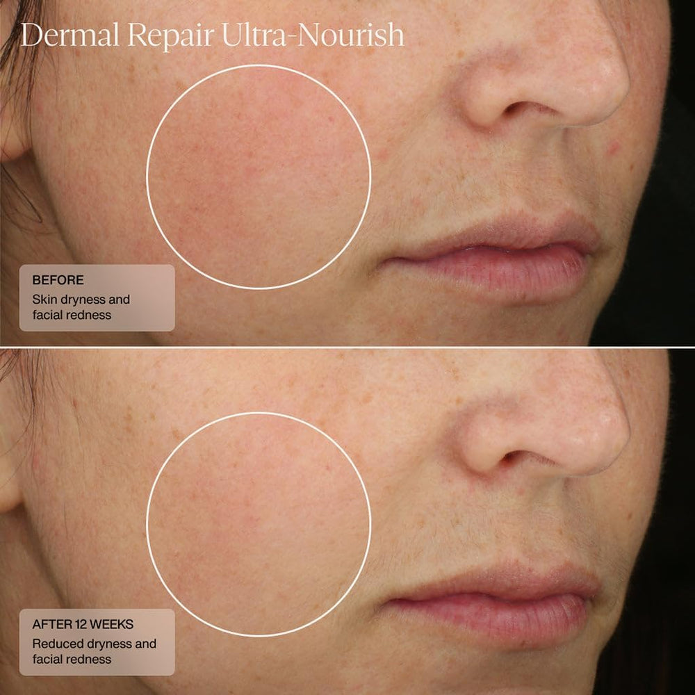 Retinol-friendly use with Senté Dermal Repair Ultra-Nourish illustrated for layering routine.