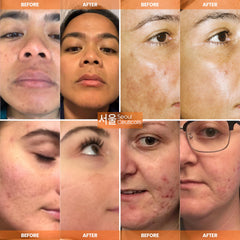 SeoulCeuticals vitamin C 20% close-up for brightening and antioxidant support.