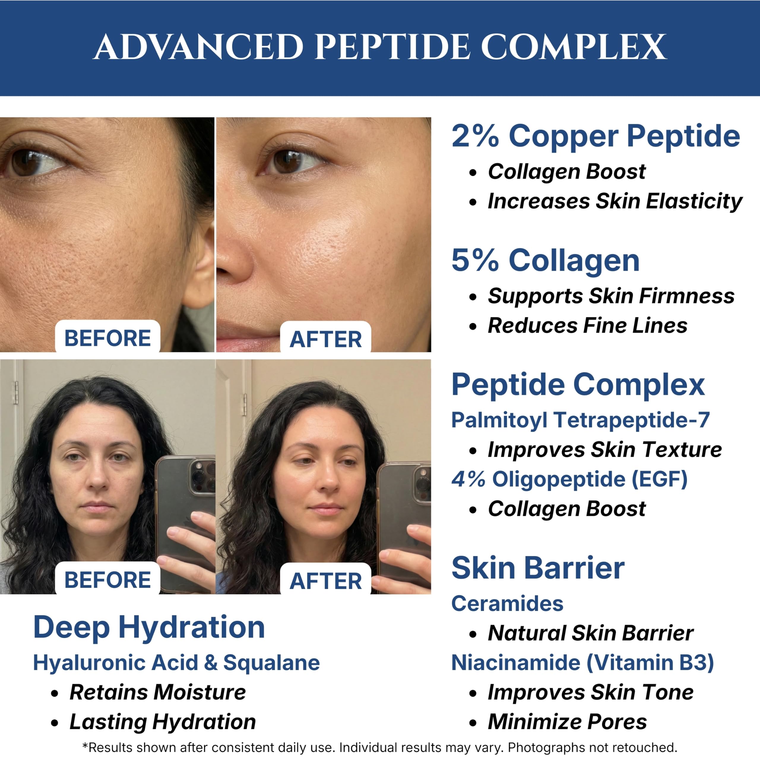 Seraphime Copper Peptides Serum with EGF for a refreshed complexion